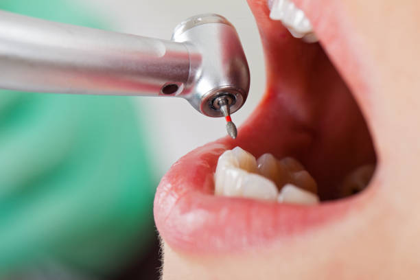 Best Emergency Care for Gum Disease in Carbon Hill, AL